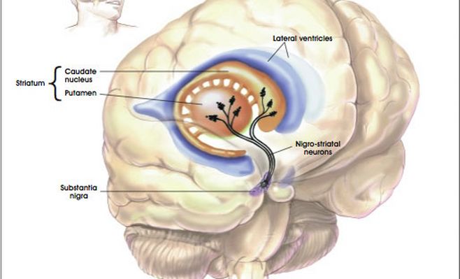 “Enfermedad de Parkinson, presente y futuro”