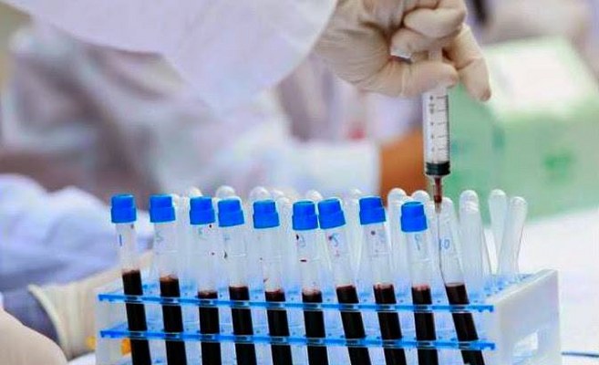 HIV